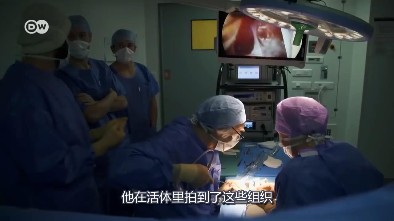 親眼看到的筋膜 親眼看到的筋膜