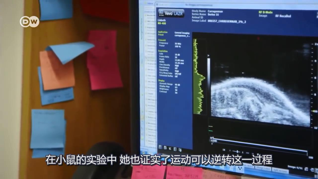 筋膜運動 筋膜運動