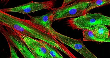 筋膜能保存記憶嗎？