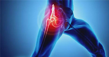 髖關節(jié)骨關節(jié)病康復概述