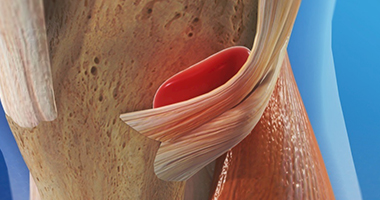 筋膜手法治療關節(jié)皮質(zhì)類固醇注射后并發(fā)癥：病例報告