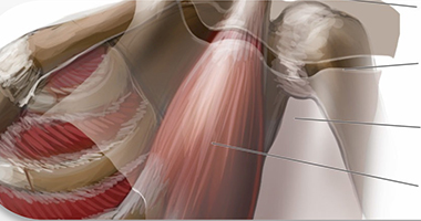 筋膜點撥——別被表象 局限你的治療！