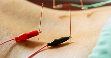 低頻針灸對筋膜肌肉的僵硬度改變